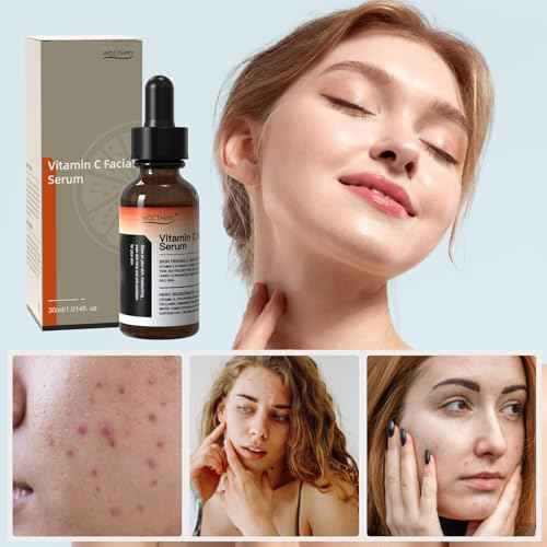 Vitamin C Serum For Face-Vitamin C&E, Hyaluronic Acid, Collagen & Niacinamide - Brightening, Hydrating & Anti-Aging Serum - Improve Dark Spots, Even Skin Tone, Wrinkles, Fine Lines for Daily Skin Care