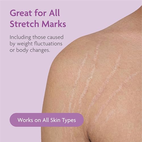 TriLASTIN Intensive Firming Stretch Mark Cream – 5.5 oz