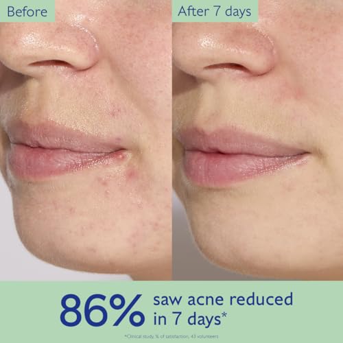 Caudalie Vinopure Acne Treatment, Salicylic Acid Serum to Treat and Prevent Blemishes - 30 mL