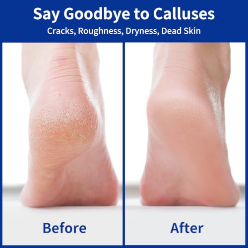 Diodiva Nano Glass Foot File - Double-Sided Heel Scraper & Callus Remover
