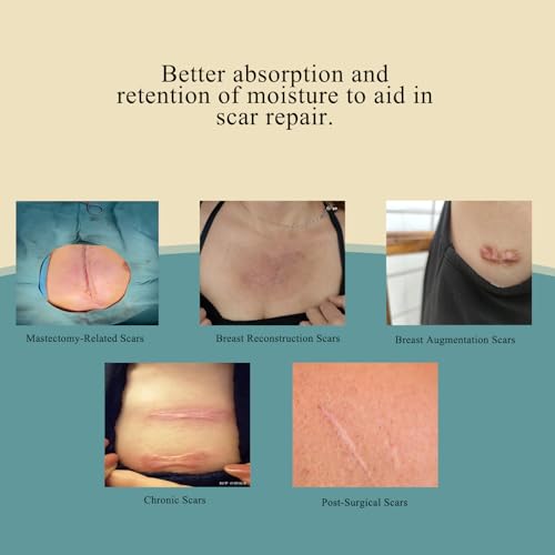 Scar Away Silicone Scar Sheets for Breast - 8 Pack (4 Areola + 4 Anchor) - Reusable for C-Section, Breast & Surgical Scars and Keloid Scars