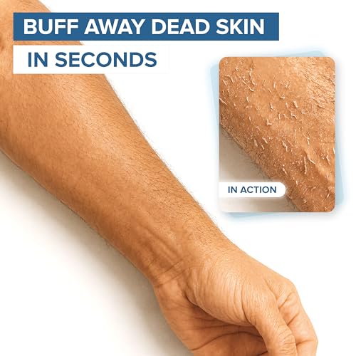 NYK1 Exfoliating Glove for Dead Skin Removal