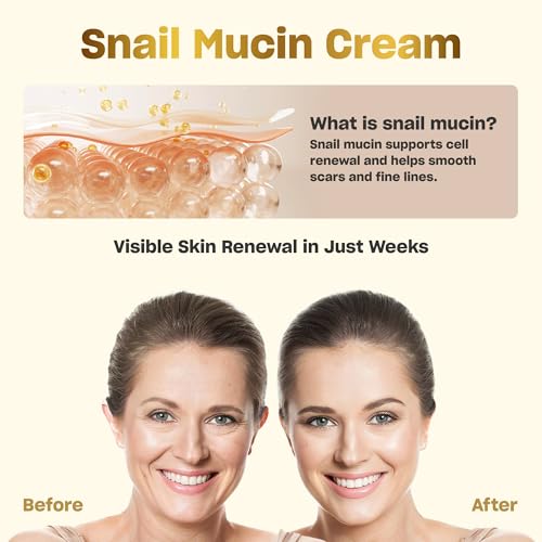 Snail Mucin Cream 93% for Skin Care, Intense Hydration & Dryness, Snail Mucin Moisturizer 120g, Natural Snail Secretion Filtrate & Non-GMO, Fast Absorbing & Non-Sticky, 4.23oz