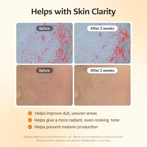 Meliturn Glutathione Cream Mask - 2% Niacinamide & Vitamin C, Visibly Fades Dark Spots & Uneven Tone Look, Brightening Korean Sheet Mask for Radiant Skin, Fragrance-Free (Butterfly Zone)