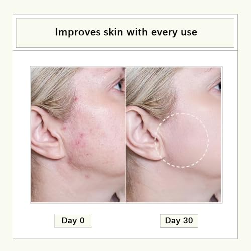 CISTTO Natural Cleansing Oil Capsules for Oily & Sensitive Skin - Travel Size 40x2ml