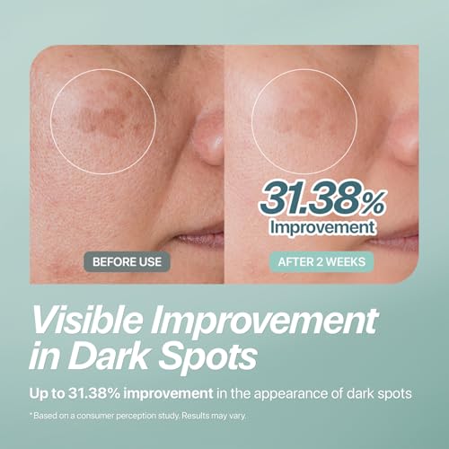CHARDE Peel Off Cream Mask for Dark Spots - 50ml Korean Skincare