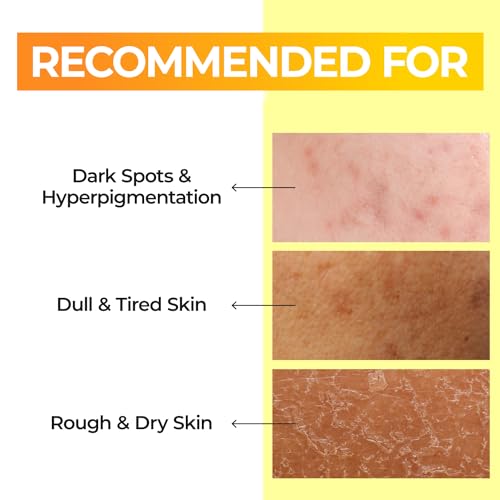 numbuzin No.5 Vitamin Boosting Essential Toner, Radiance-Boosting Vitamin Toner for Uneven & Dull Skin, Glutathione, Vitamin C, Niacinamide, First Step Skincare, 6.76 fl oz (200ml)