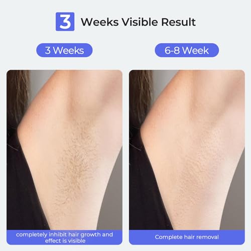 IPL Laser Hair Removal Device with Sapphire Ice Cooling - Nearly Painless, 21J, 41°F