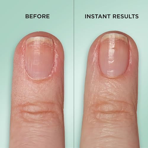 Sally Hansen Gel Rehab Nail Treatment Pen | Strengthens & Repairs