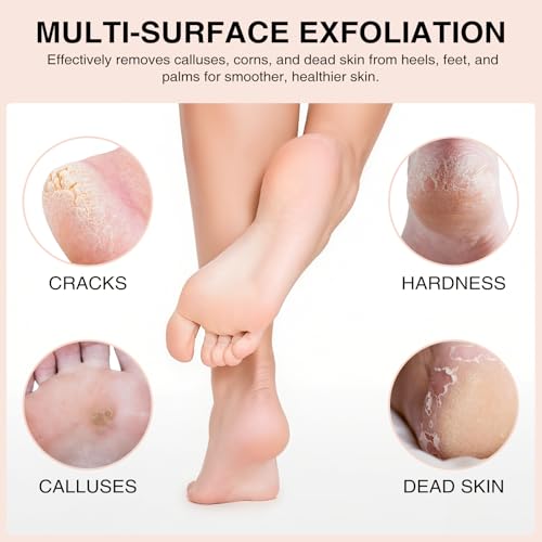 Natural Volcanic Lava Pumice Stone Set - 3-Pack Foot Scrubber for Calluses