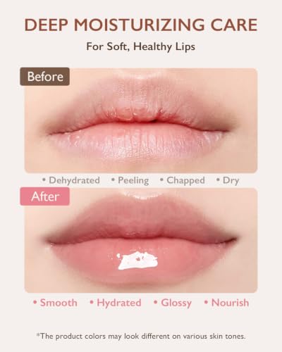 5-Piece Lip Balm Set with Shea Butter & Avocado Oil