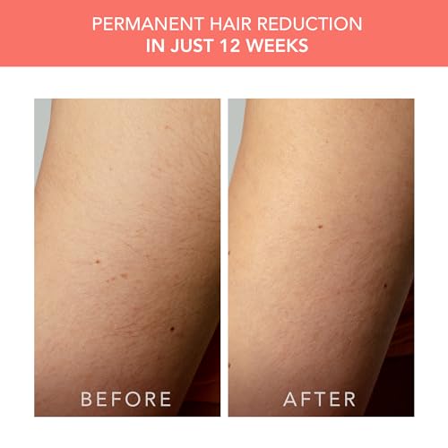 Travel-Friendly IPL Hair Removal Device - Peach 2 Go Coral - Painless Body & Face Treatment
