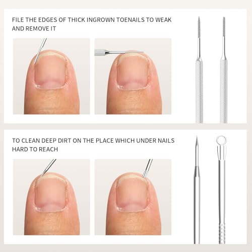 7-Piece Ingrown Toenail Removal Kit - Stainless Steel Pedicure Tools