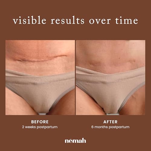 Nemah Restorative Scar Treatment Cream, 1 Oz