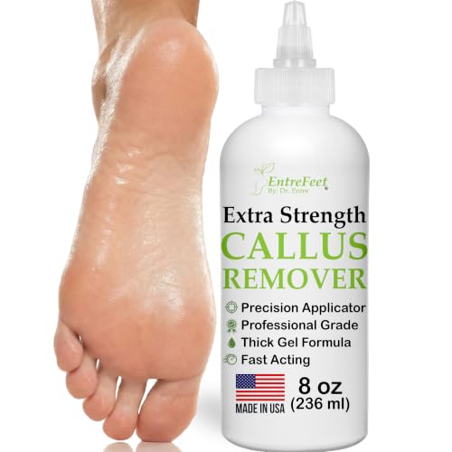 EntreFeet 8 Oz Callus Remover Gel – Extra Strength Foot Callus Remover for Feet (Variation: 8 Oz Callus Remover Gel)