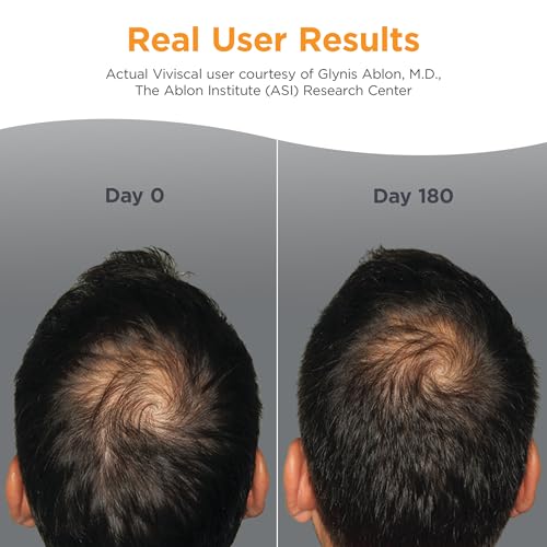 Viviscal Men's Hair Growth Supplements 180 Tablets