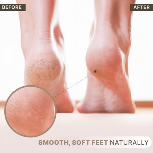 Beauty by Earth Natural Lava Pumice Stone for Feet - Callus & Dead Skin Remover