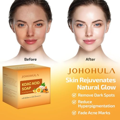 Kojic Acid Dark Spot Remover Soap Bars with Vitamin C, Retinol, Collagen, Turmeric - Smooth for Face and Body, Firm and smooth skin - 3 X 100g Bars