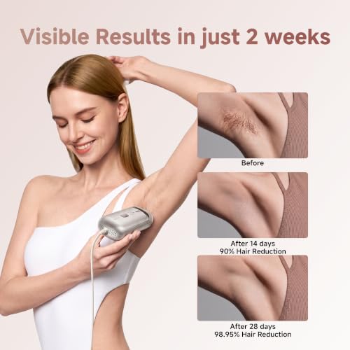 IPL Hair Removal Device for Full Body with Dual Lamp & Cooling - 27J Output