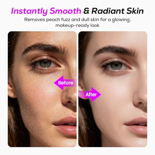 Dermaplane Razor for Women Face, Painless Sonic Dermaplane Tool with 10 Upgraded Micro Mesh Dermaplaning Blades, Women¡¯s Facial Exfoliation & Peach Fuzz Hair Removal System (Off-White)