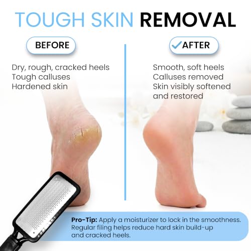 Colossal Foot Rasp File & Callus Remover | Stainless Steel