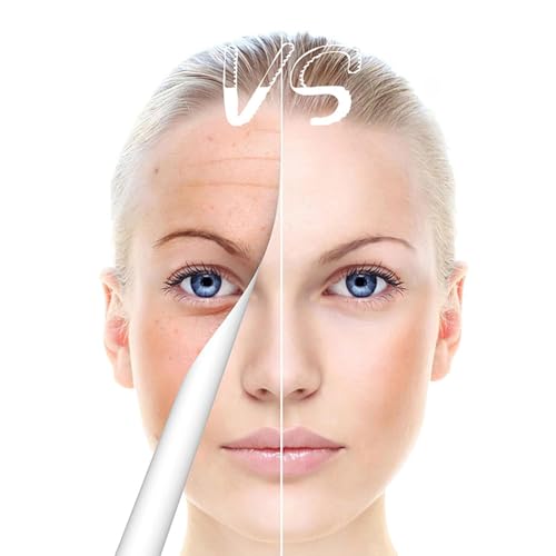 Derma Roller Pen 0.25mm Microneedling Tool for Face & Hair - Home Use