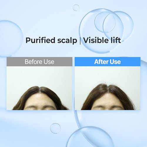 KUNDAL Hyaluronic Acid Hair Serum Set for Deep Hydration & Volume