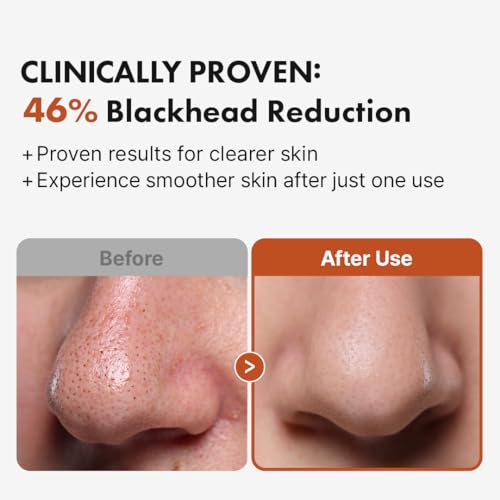 Hanskin BHA Pore Cleansing Oil for Oily Skin, 10.14 oz
