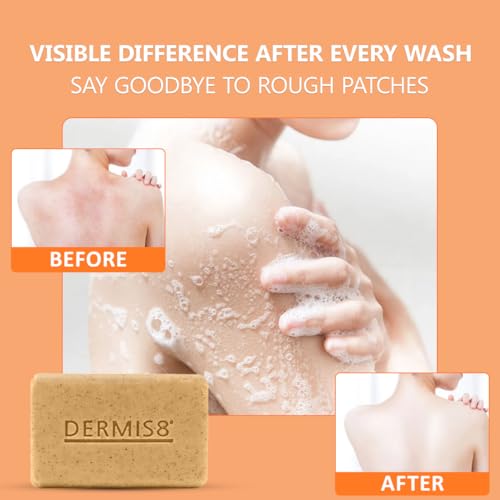 Dermis 8 Natural Carrot Soap Bar ? Brightening & Nourishing Face & Body Soap ? Made with Carrot Extract, Jojoba & Camellia Oils (200g x 6 Pack)