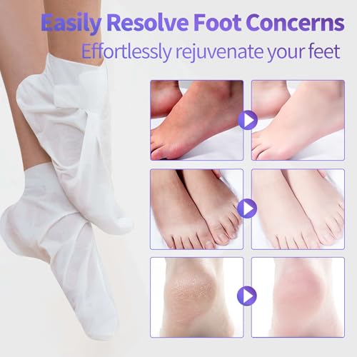 CRISTALBOX 5-Pack Moisturizing Foot Mask Socks for Dry Cracked Feet