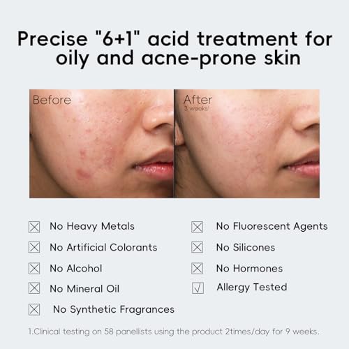 Face exfoliant skin peel serum -3% lactic acid serum,1% azelaic acid,0.5% salicylic acid,multi-acne/oily skin care,skin peel,smooth skin,Anti-wrinkle,For sensitive skin
