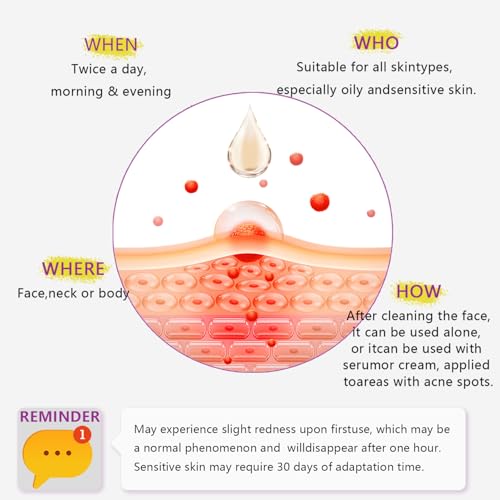 Azelaic Acid, 12% Azelaic Acid For Face Serum Rich in Niacinamide and Hyaluronic Acid, Fades Post Acne Marks and Calms Redness, Formula for Uneven and Blemish Prone Skin Care 1 OZ