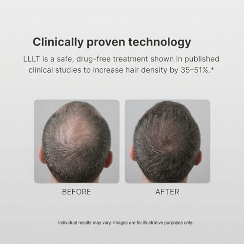 Xtrallux Laser Hair Growth Cap 316 Diodes | 6-Min Treatment