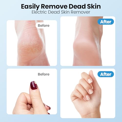 Mosthink Pearl White 2-in-1 Electric Callus Remover & Pedicure Tool Gift