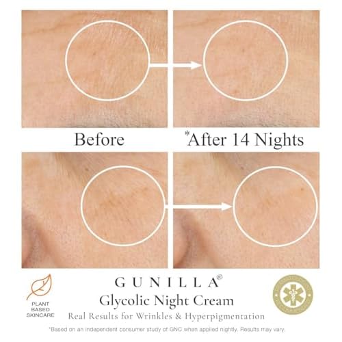 GUNILLA Glycolic Acid Night Cream - Refine, Resurface & Reduce Fine Lines, Wrinkles, Dark Spots, Congested Pores While Brightening Complexion. Gentle - Natural - Vegan (2 oz)