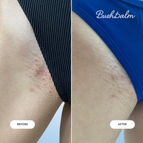 Bushbalm Ingrown Hair & Razor Bumps 2-Step Kit - Oil & Scrub