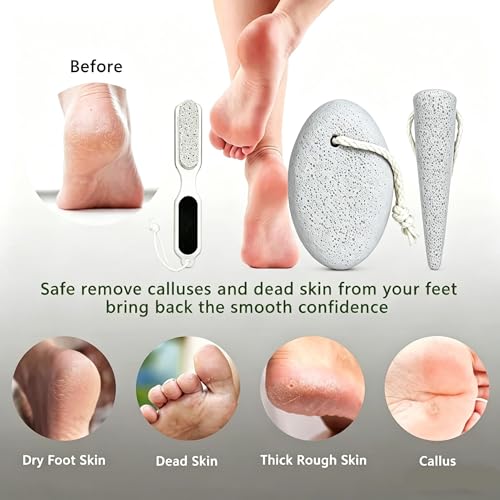 3PCS Pumice Stone Pedicure Tools Set - Oval, Tapered & Brush