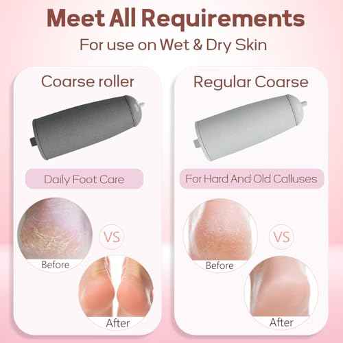 Electric Foot Callus Remover, Callus Remover for Feet Rechargeable Portable Pedicure Tool Kit, Smooth Pedicure Wand for Feet Care, Removes Dry Hard & Dead Skin Ideal Gift (White)