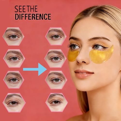 Under Eye Patches Masks - for Puffy Eyes, Dark Circles, Eye Bags and Wrinkles with Collagen & Hyaluronic Acid Hydrogel Under Eye Mask for Women and Men