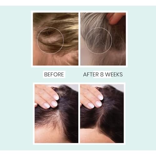 Actitud Advanced Hair Growth Serum for Hair Fall Control & Hair Growth - 3% Redensyl, 4% Anagain, 2% Baicapil, Caffeine, Biotin & Rice Water 30ml