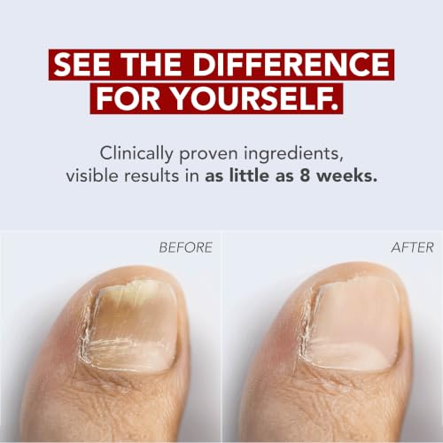 Kerasal Fungal Nail Renewal & Files Pack - 0.33 Fl Oz, Discolored & Damaged Nails