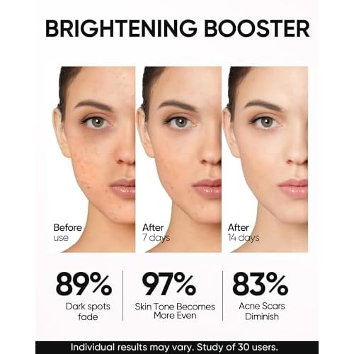 10% Niacinamide Serum with Alpha Arbutin, Ceramide & Centella Asiatica ? Brightens Skin, Maintains Skin Barrier