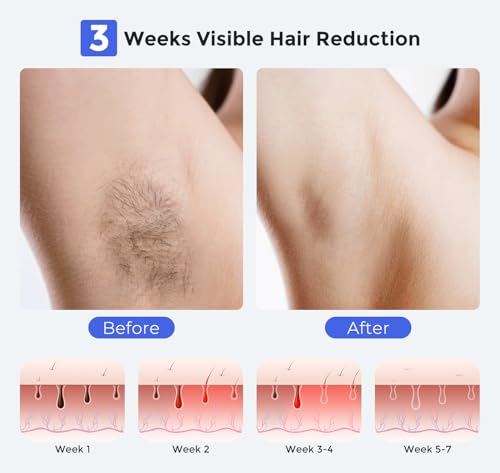 IPL Laser Hair Removal Device for Face Body & Bikini - Painless, Reusable & Cooling