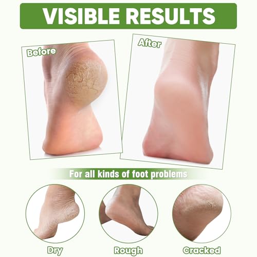 TEAWOO 8 Pairs Moisturizing Foot Masks with Aloe Vera & Jojoba Oil
