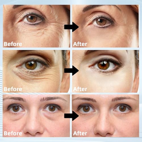 60Pcs Retinol Collagen Under Eye Patches for Dark Circles