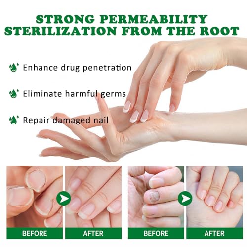 Ginger Nail Growth Serum & Cuticle Care Oil - Nail Strengthener, 3 Pack