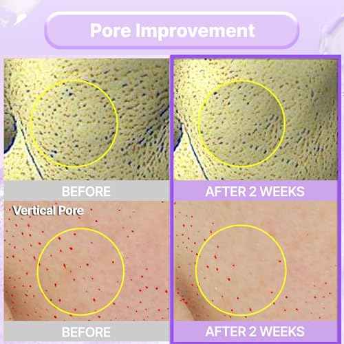 BIOHEAL BOH Probioderm¢â Collagen Remodeling Cream 1.69 fl oz (50 ml) | Pore Tightening Cream with 150,000 Collagen Capsules for Firmness & Smooth Texture | Lightweight Moisturizer for Flawless Skin