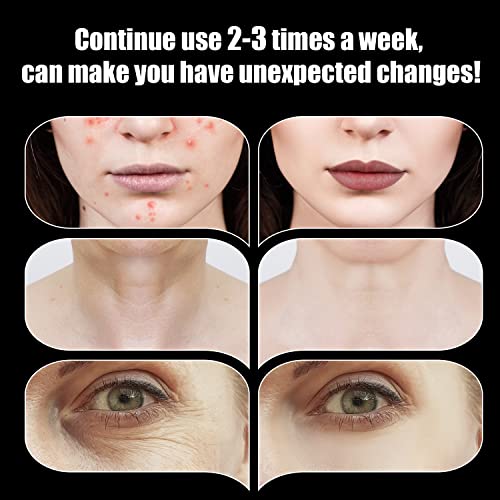 High Frequency Facial Wand with 6 Tubes - UUPAS Portable Machine