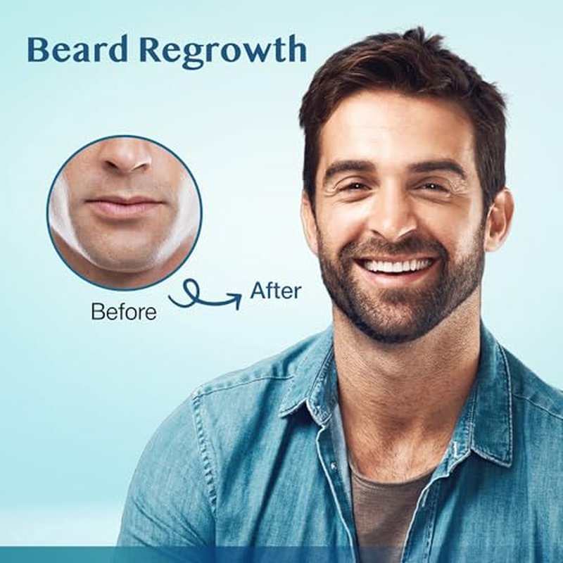 5% Minoxidil Hair Growth Serum for Men & Women 180ml