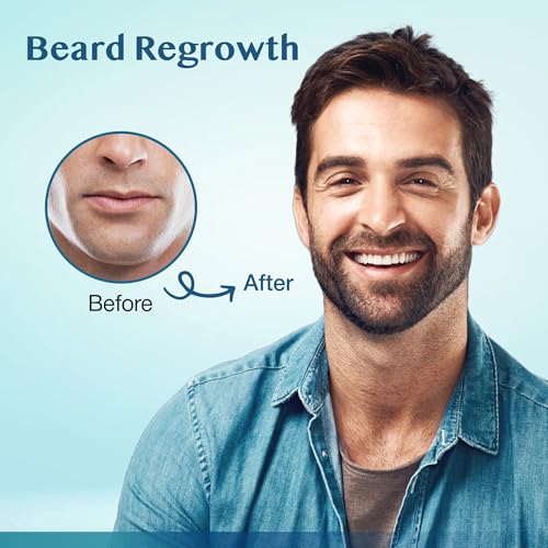 5% Minoxidil Hair Growth Serum for Men & Women - Extra Strength Beard Treatment 180ml